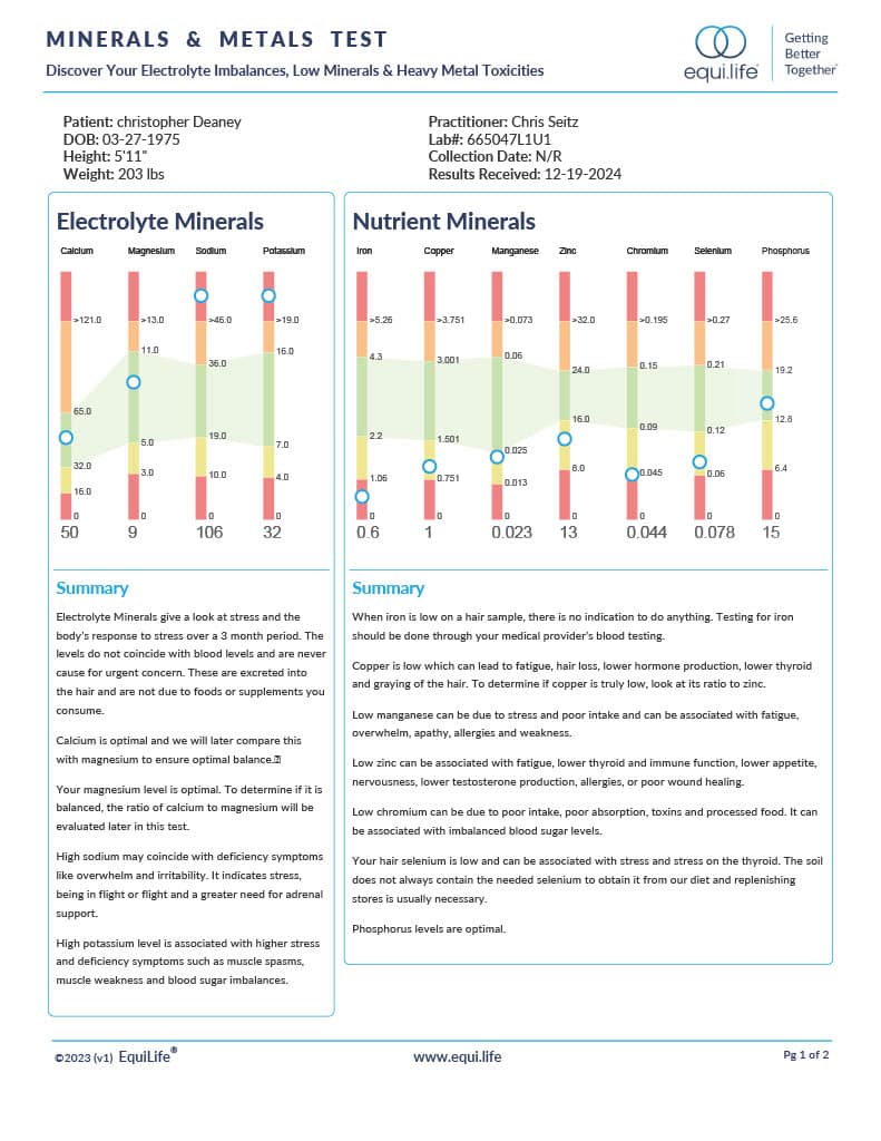 Hair tissue mineral analysis chart displaying electrolyte and nutrient mineral levels for health assessment.
