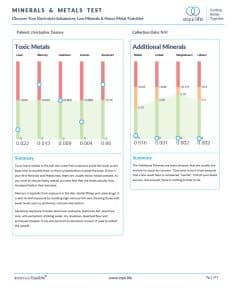 Hair tissue mineral analysis chart showing toxic metals and additional minerals test results.
